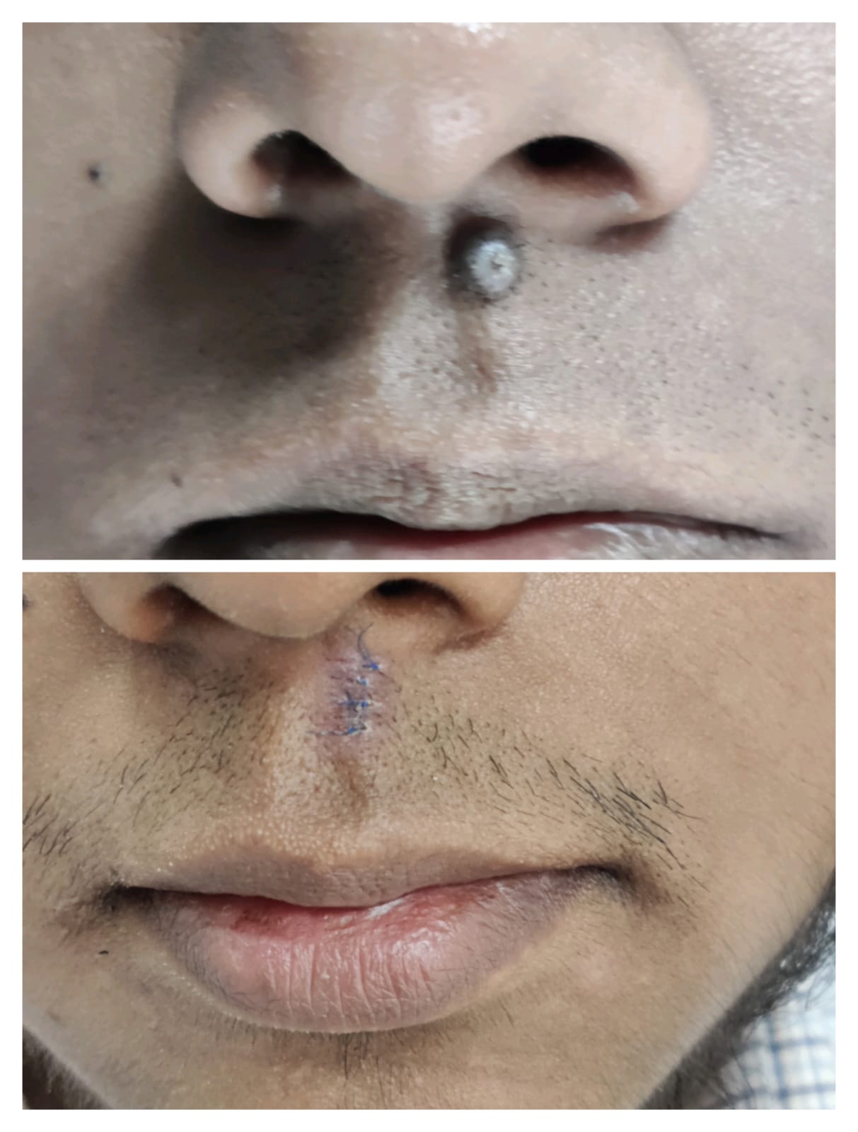 কসমেটিক সার্জারি: চেহারার উন্নয়ন এবং দাগ সংশোধন