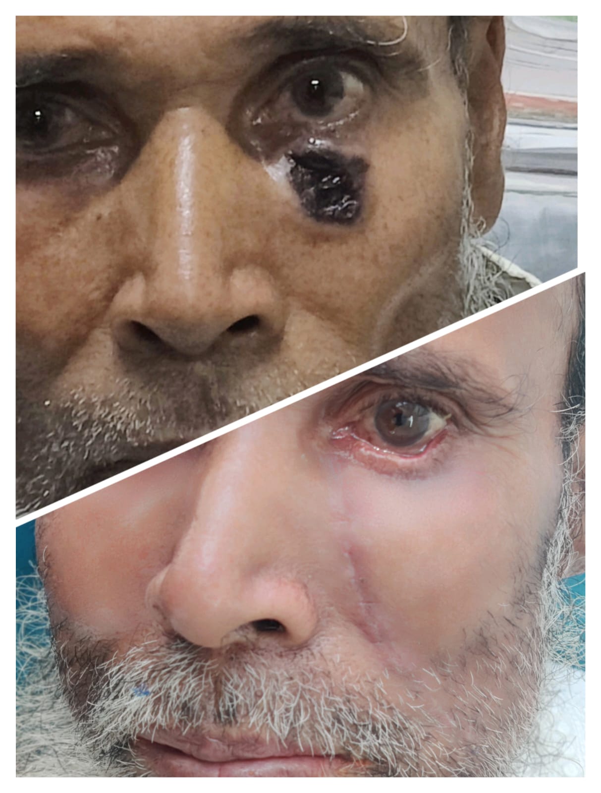 রিকনস্ট্রাকটিভ সার্জারি: ত্রুটি সংশোধন ও পুনর্গঠনমূলক চিকিৎসা